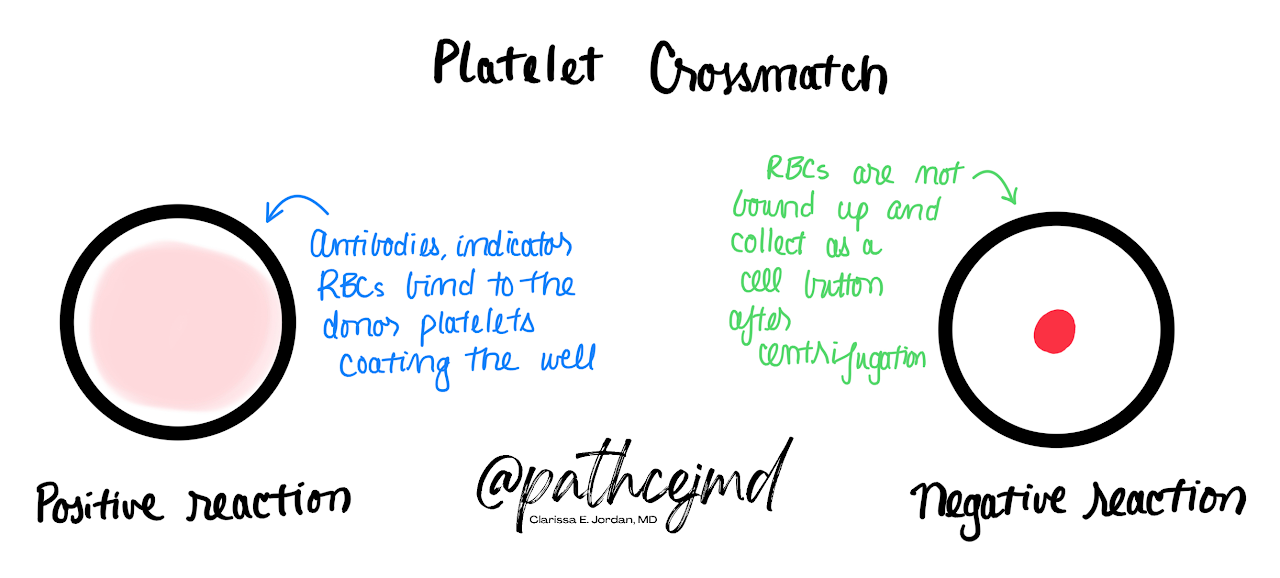 Case 5: Platelet Refractoriness