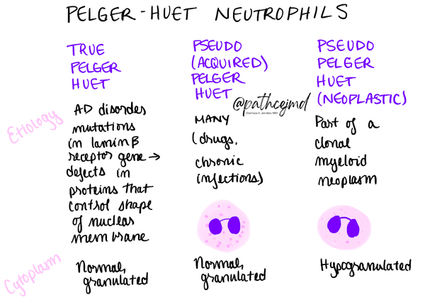 Case 3: Pelger-Huet vs Pseudo-Pelger-Huet Neutrophils Infographic